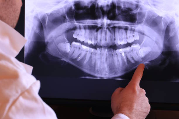 Best Walk-In Emergency Dental Services in Eagle Butte, SD