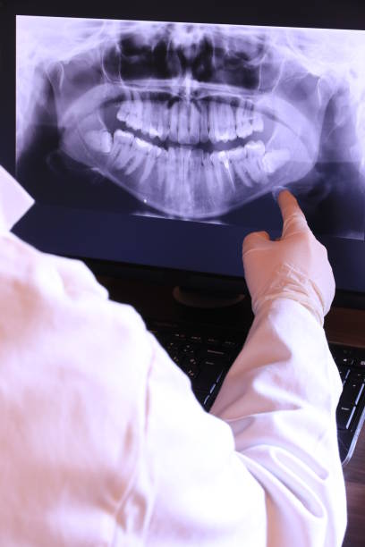 Best Emergency Root Canal Therapy in Eagle Butte, SD