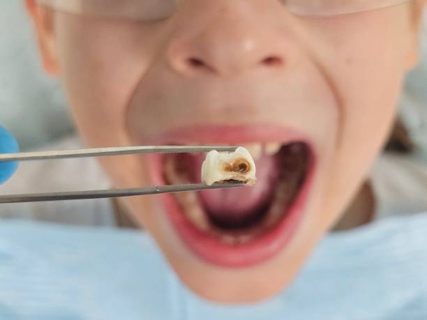 Best Emergency Orthodontic Repairs in Eagle Butte, SD