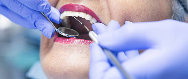 Best Emergency Dental Care for Sports Injuries in Eagle Butte, SD